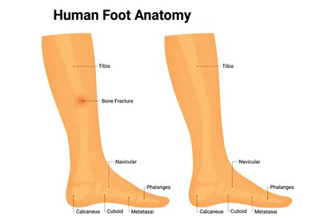 Human Foot Anatomy Science Design Vector Graphic by hamjaiu · Creative ...