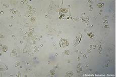 tappeto di emazie epithelial cells tappeto di emazie epithelial cells