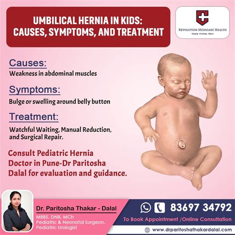 Newborn Umbilical Hernia