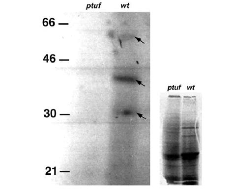 Labeling of selenoproteins with Na2 75 SeO4 (left) and [ 35 ...