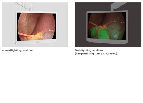 An image showing how the Auto Panel Brightness Adjustment function works