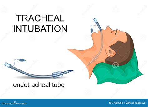 Trachea Versus Esophagus
