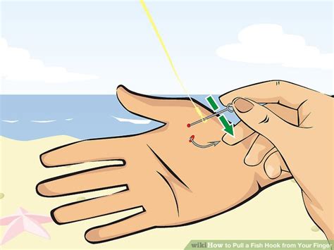 Image result for String Pull Method Fish Hook Removal
