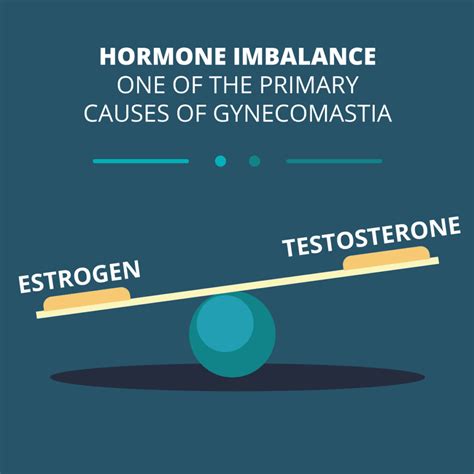 Best Treatment for Bodybuilder Gynecomastia Explained