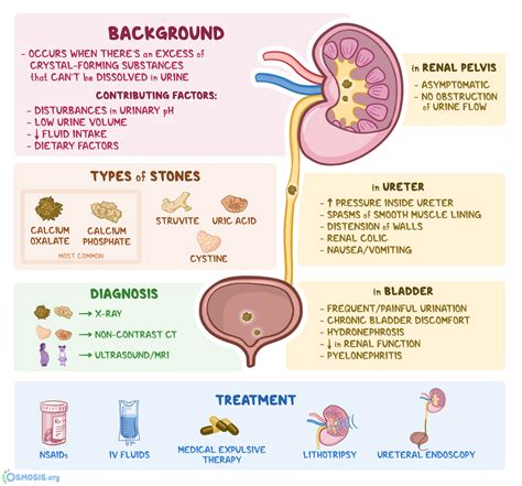 Nephrolithiasis: What Is It, Types, Signs and Symptoms, Diagnosis | Osmosis