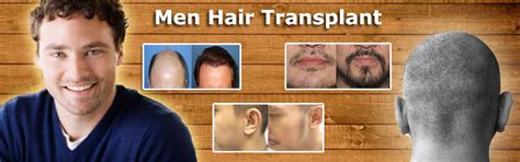 The Sparsh Klinic : Hair Transplant Centre in Lucknow by FUE technique