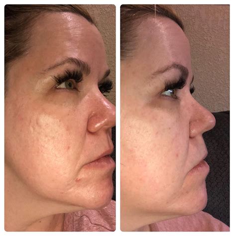 LED Mask Reviews 的图像结果