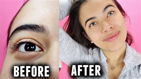 Image result for Eye Color Surgery