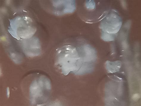 Bladder snail eggs a few days after the last post i made about them ...