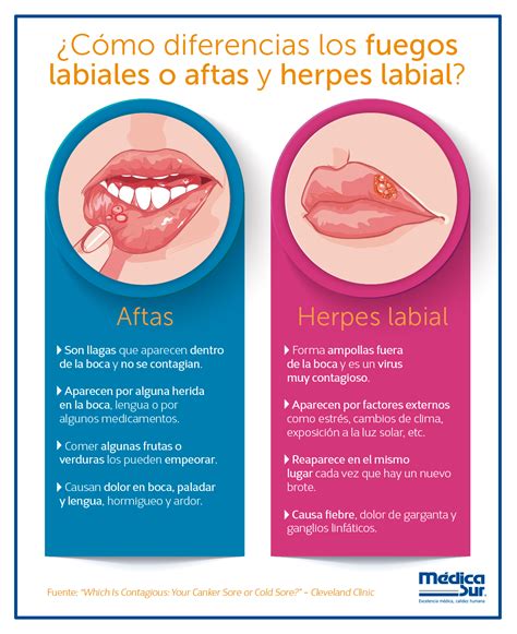 Which Is Contagious: Your Canker Sore or Cold Sore?