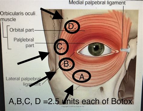 Crow's Feet And Bags Under Eyes at Mary Langan blog