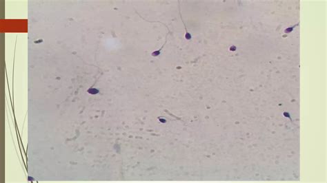 Sperm_Morphology.pptx
