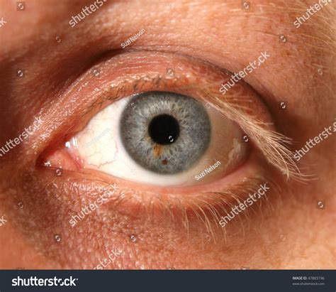 Close Eye Birthmark Stock Foto 47865196 - Shutterstock