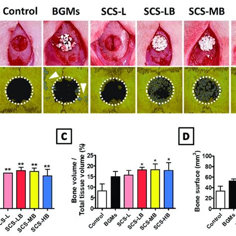 Image result for Bone Tissue Formation
