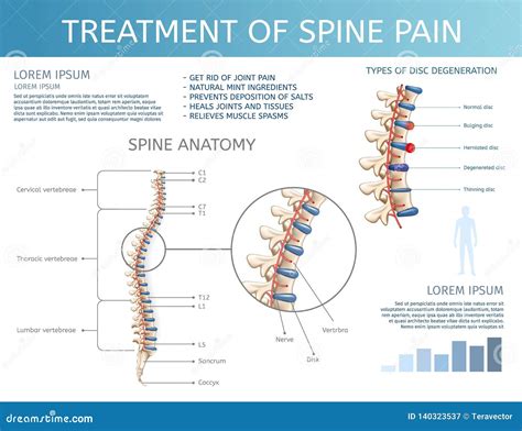 Vector Treatment of Spine Pain. Spine Anatomy. Stock Vector - Illustration of pain, back: 140323537