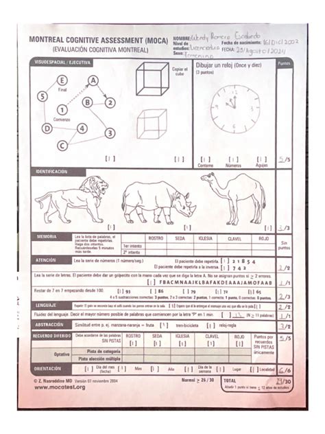 Montreal Cognitive Assessment (Moca) | PDF