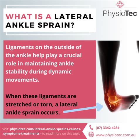 Lateral Ankle Sprains in Dancers: Causes, Symptoms, Treatments