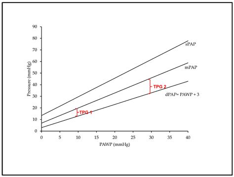 Pulmonary Hypertension in Left Heart Diseases: Pathophysiology ...