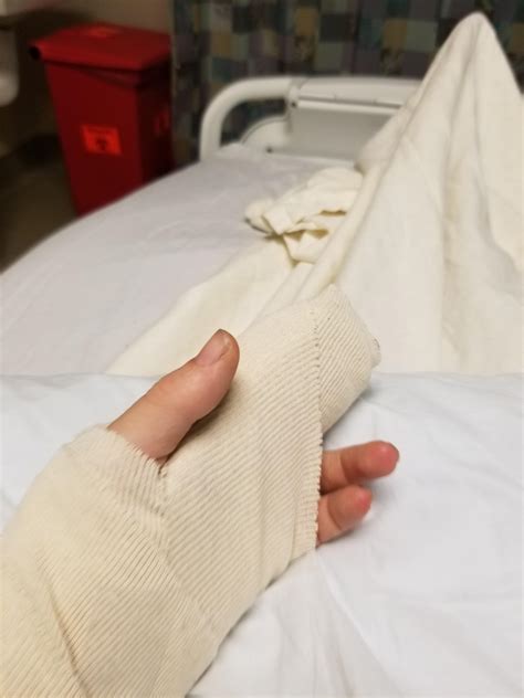 Was hospitalized for 24hrs for a cat bite, and know all the names of the cats the nurses and ...