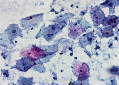 Gynecological cytology | Atlas of Pathology