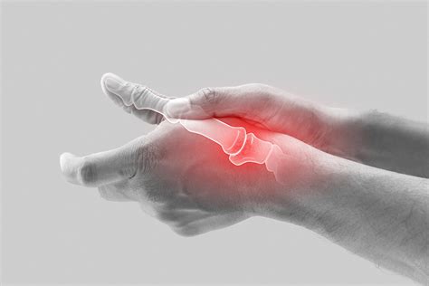 Jammed Thumb: Signs, Treatment, and Recovery | NatraCure - NatraCure