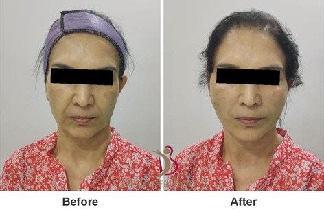FROM THE EXPERT’S DESK | Pocketmags.com - Aesthetic Medicine India Magazine