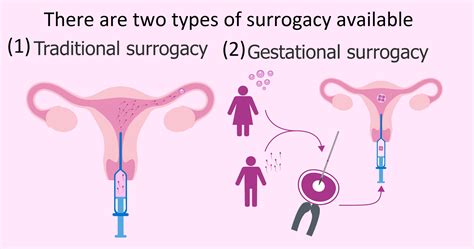 Artificial insemination cost with surrogate - Surrogate Mother Kenya