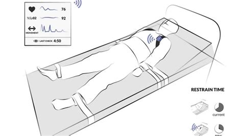 ¿Se puede tratar a pacientes agitados mediante un procedimiento fiable