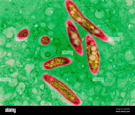 Coloured transmission electron micrograph (TEM) of Mycobacterium avium complex (MAC) infection ... - mac lung infection