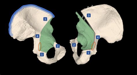 髋臼周围截骨术PAO：基于增强现实技术的复杂骨盆截骨手术导航——一项在尸体上的可行性研究：2021年_骨盆骨折_骨盆骨折治疗方式 - 好大夫在线
