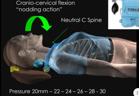 Image result for Motor Control Cervical Rotation
