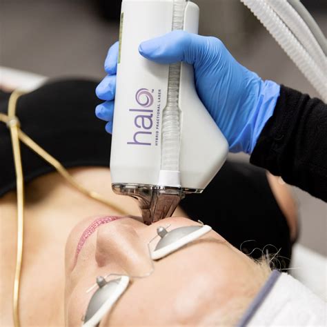 Halo Laser Treatments - Spotless Laser