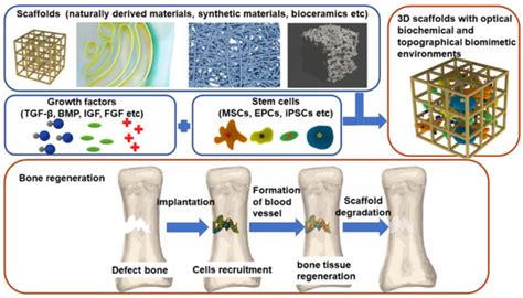 Current Biomaterial-Based Bone Tissue Engineering and Translational ...