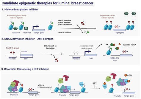 Treatment For Luminal A Breast Cancer