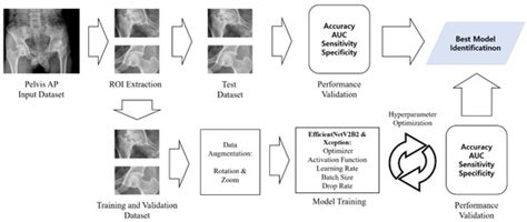 Convolutional Neural Network Algorithm Trained with Anteroposterior ...