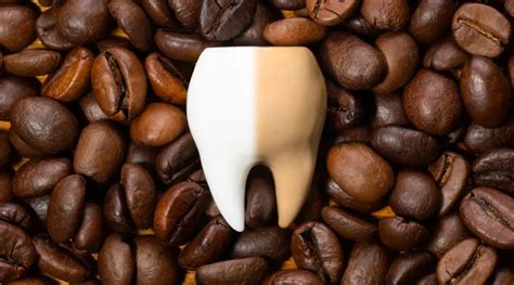 Image result for Tooth Stain