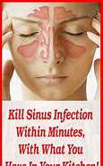 Image result for Sinus Infection Treatment