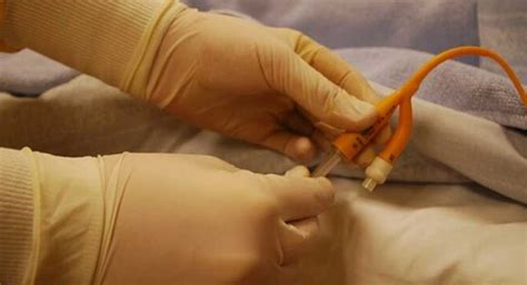 Image result for Teleflex Medical Devices