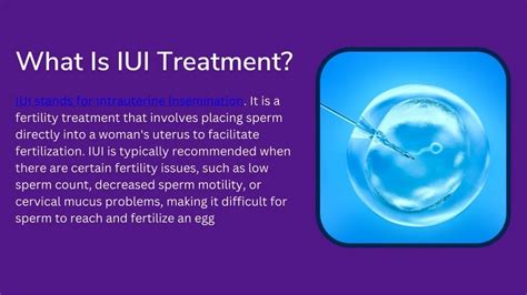 How Is IUI Procedure Done 的图像结果
