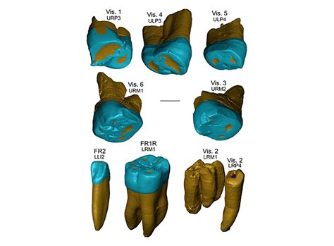 Scientists Found an Unexpected Sign of Human Longevity—Our Teeth