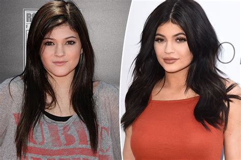 Fans roast Kylie Jenner for 'lying' about plastic surgery