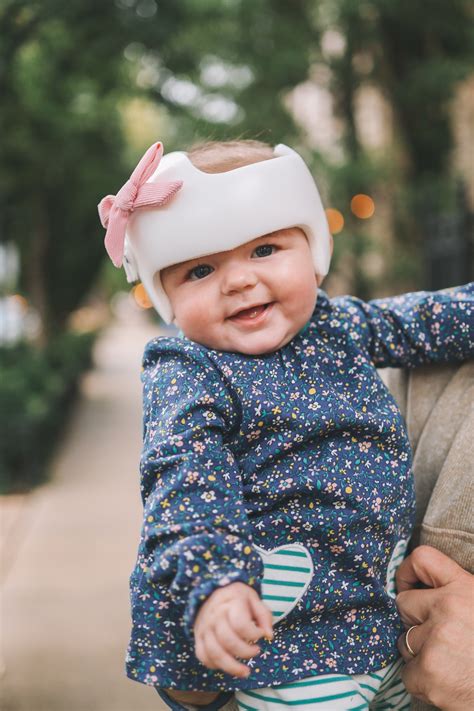 Plagiocephaly and Lucy's Helmet | Kelly in the City
