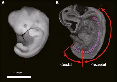 Human Embryo Tail