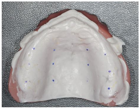 Comparison of the Accuracy between Denture Bases Produced by ...