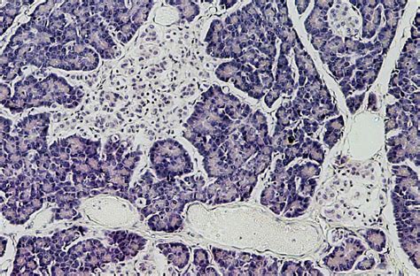 Image result for Beta Cell Structure