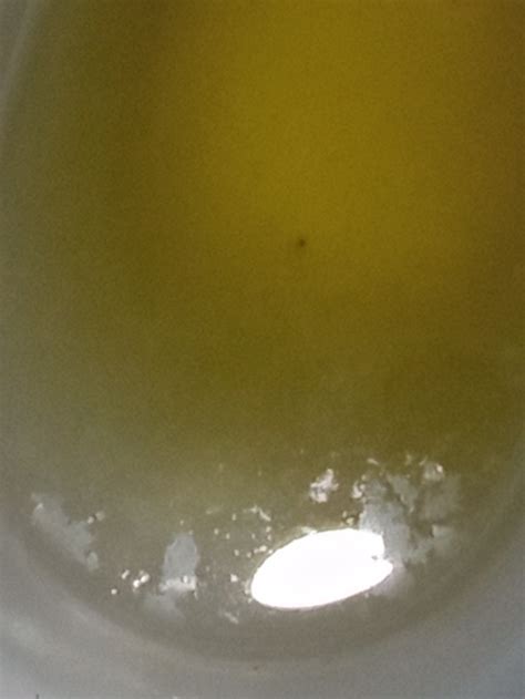 White stuff in my urine. : r/kidney