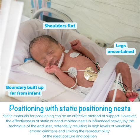 Types Of Nicu Beds at Donte Galiano blog