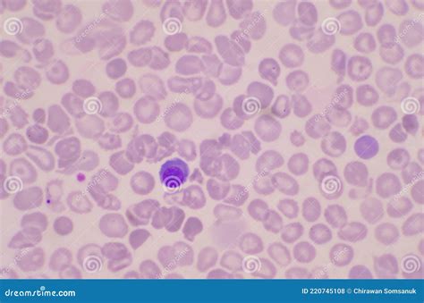 Nucleated Red Blood Cells
