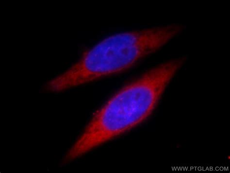CPT1A antibody (15184-1-AP) | Proteintech