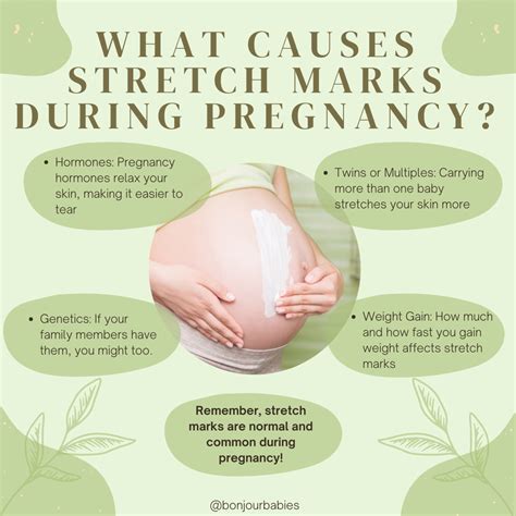What Causes Stretch Marks